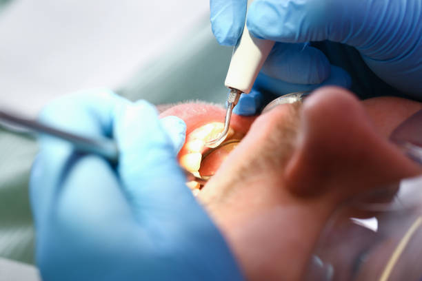 Best Emergency Dental Care for Abscessed Tooth in Tazewell, TN