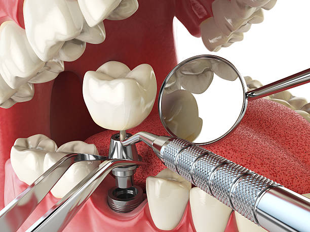 Best Emergency Dental Services for Seniors in Tazewell, TN